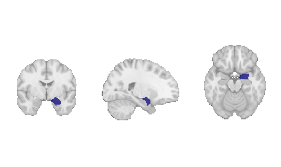 _images/12_decoding_11_0.png