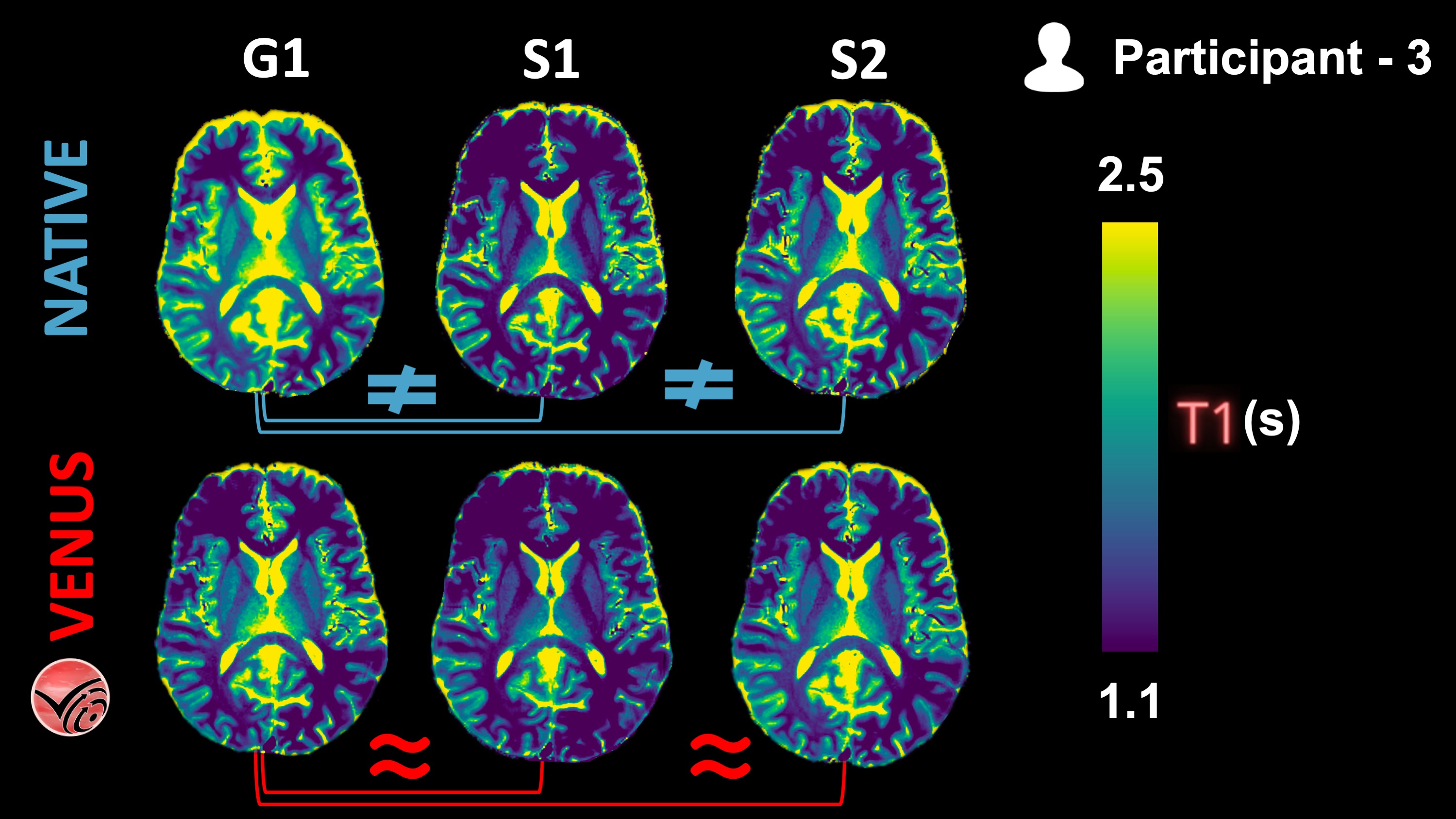 Vendor-native and VENUS quantitative T1 maps from P3 are shown in one axial slice.