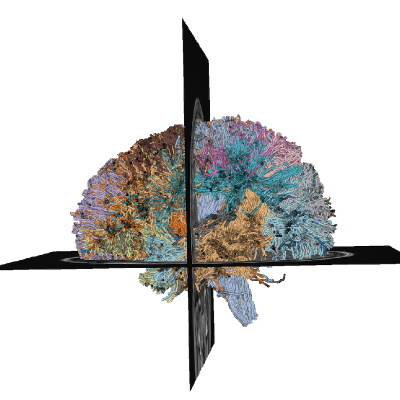 Tractometry