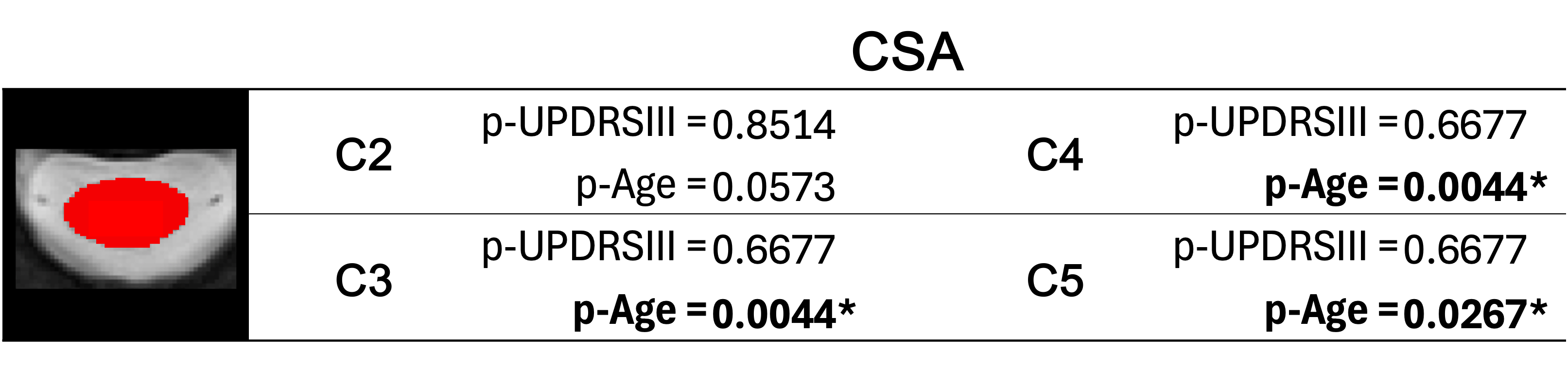 Table 1. P-values for UPDRSIII and Age variables for the cross-sectional area (CSA) following ordinary least squares (OLS) analysis. The significance level was corrected for each metric, by dividing α=0.05 by the number of spinal levels studied.