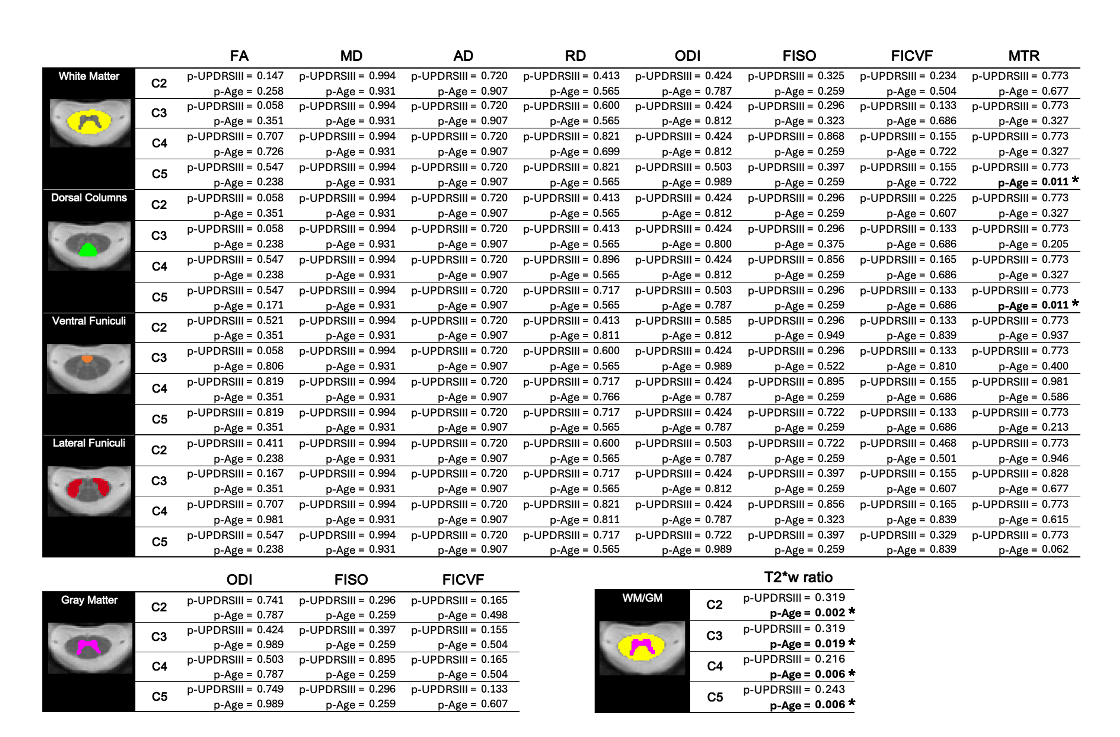 Table 3. FDR-corrected p-values for UPDRSIII and age predictors for the OLS regression model (metric = UPDRSIII + Age)