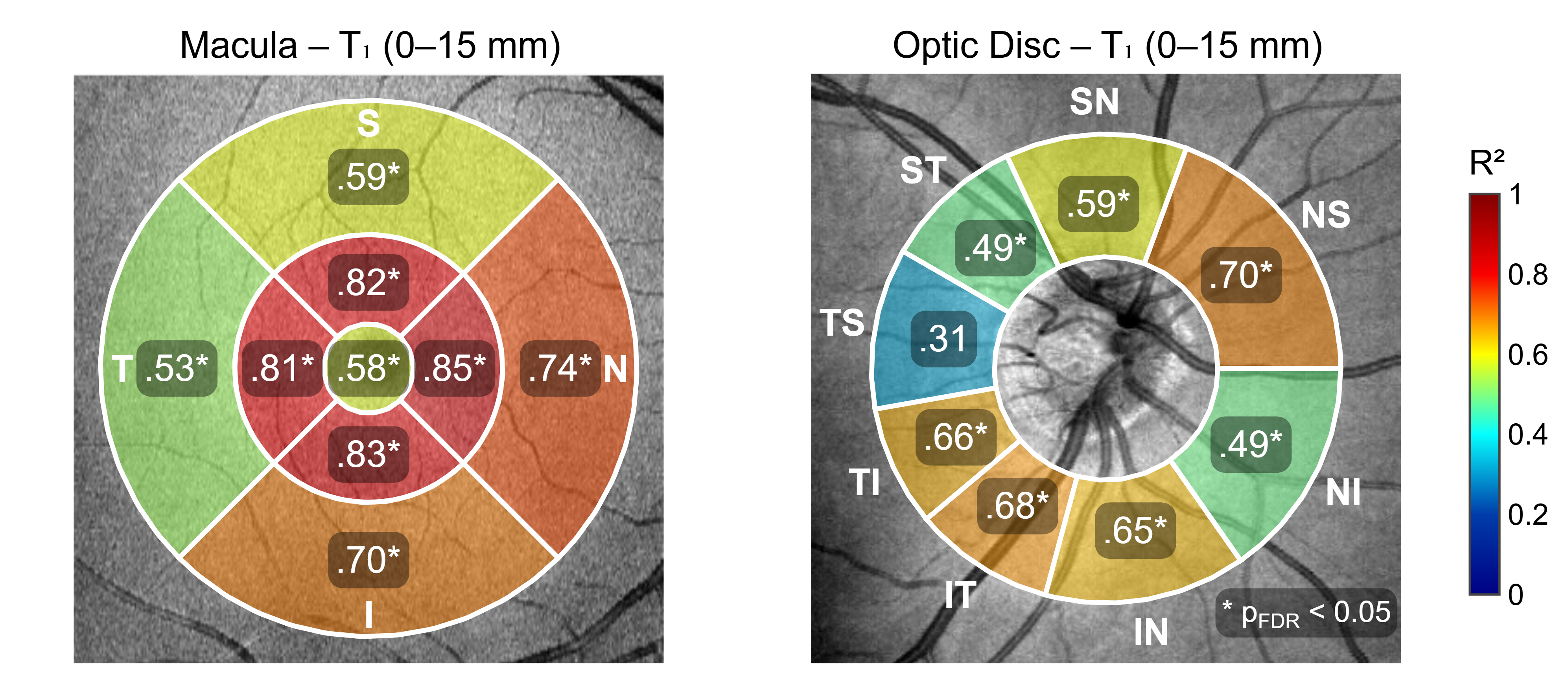 Coupling between MRI- and OCT-based metrics. Sector-wise results relating mean intraorbital optic nerve T_1 to retinal thickness measured by OCT. Left: macular ganglion cell complex (GCC) sectors. Right: optic disc retinal nerve fiber layer (RNFL) sectors. Color intensity reflects the strength of association (R^2_m), and inset values indicate FDR-corrected p-values. Stronger associations were observed in central and nasal macular sectors, while several superior-nasal and inferior-temporal RNFL sectors demonstrated significant relationships. All significant associations were negative, indicating shorter T_1 values (i.e., increased myelin content) in eyes with greater retinal thickness. Data can be explored in further detail by following the instructions presented in .